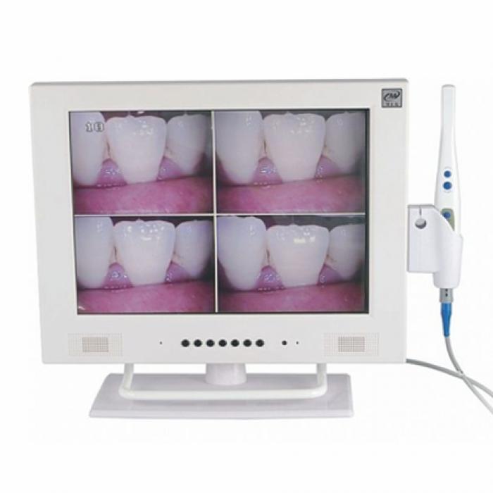 MLG® M-958A Videocamere intraorali 15" schermo LCD con WIFI