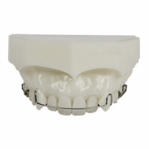 Modello ortodontico Manutenzione da Trattamento M3007