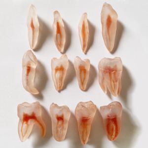 12 pezzi repliche di denti di simulazione 3D (per pratica del Lime endodontiche dentali)