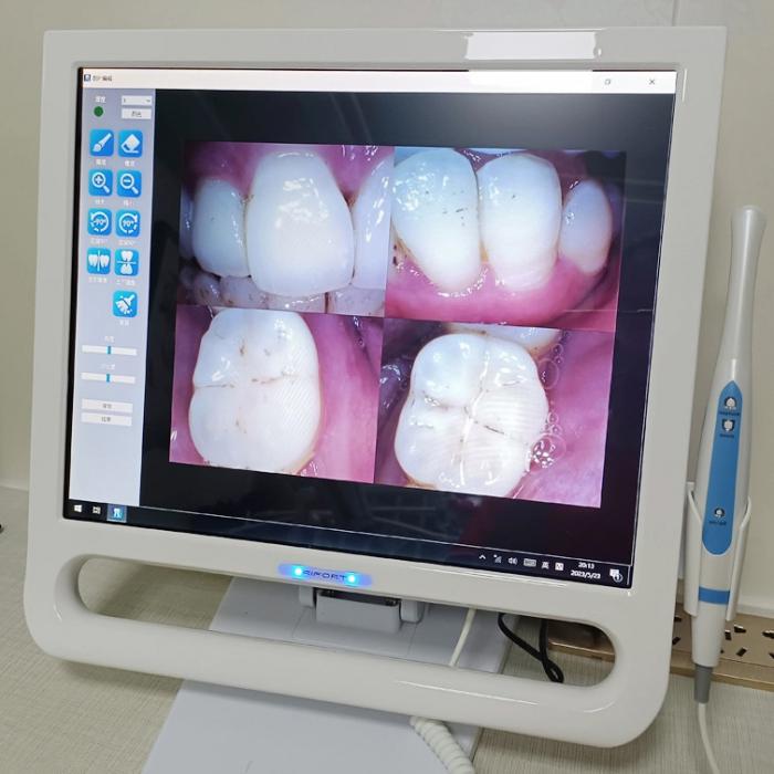 Magenta YF-1700P+ Telecamera intraorale dentale touch screen da 17 pollici