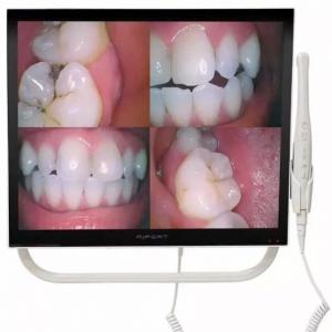 Magenta YFHD-D telecamera intraorale dentale 1/4 Sony CCD con monitor da 17 poll...