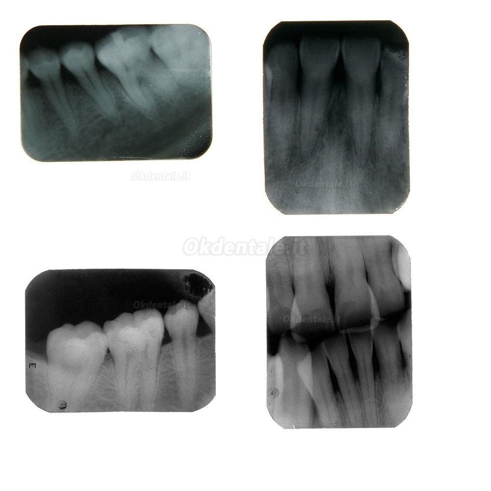 Appareil Radiographique dentaire portable BLX-5