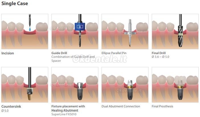 Kit guida impianto Dentium (Kit ISGK) / Kit strumenti odontoiatrici