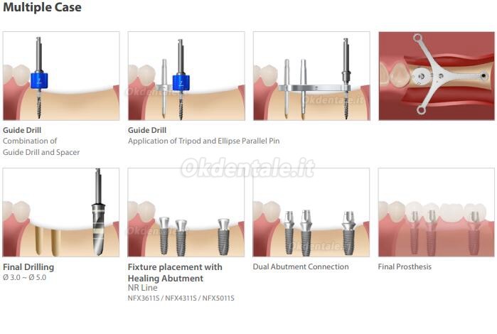 Kit guida impianto Dentium (Kit ISGK) / Kit strumenti odontoiatrici