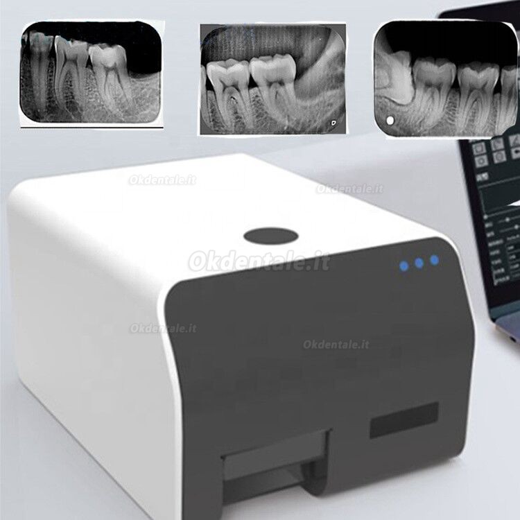 Vrn EQ 600 scanner ai fosfori dentale scanner psp