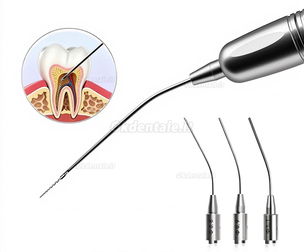 Kit di rimozione di lime endodontiche / Sistema per la rimozione di strumenti endodontici Kit di rimozione di lime endodontiche / Sistema per la rimozione di strumenti endodontici