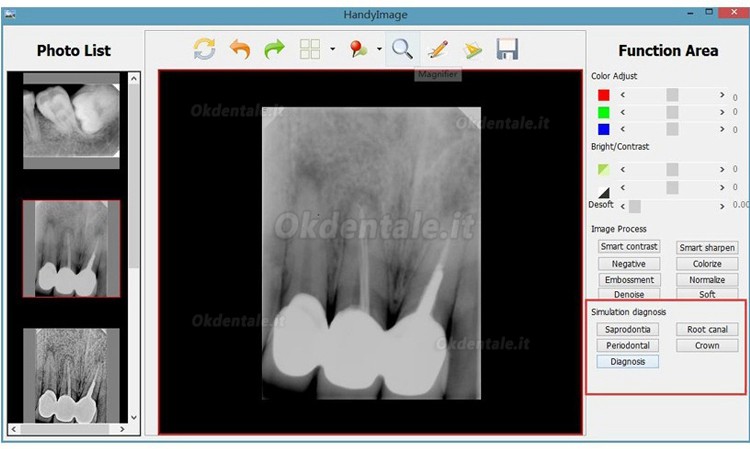 Handy HDR-500 Dentale sensori endorali sensori intraorali digitali usb