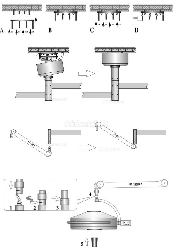 KD-2036D-2 36LED Lampada scialitica odontoiatrico con profondità di illuminazione regolabile (a soffitto)