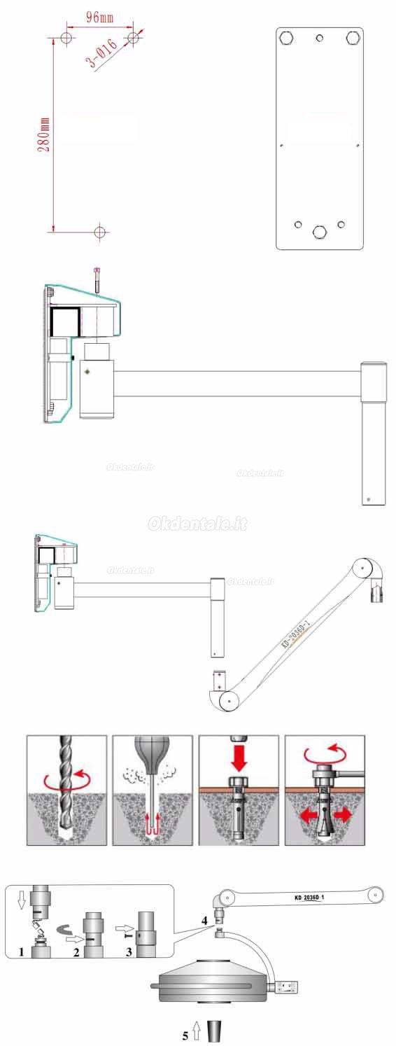 KD-2036D-2 36LED Lampada scialitica odontoiatrico con profondità di illuminazione regolabile (a muro)