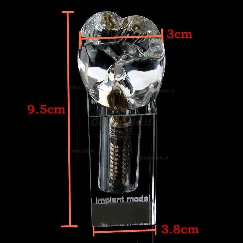 Cristallo modello di impianto dentale M2019-II