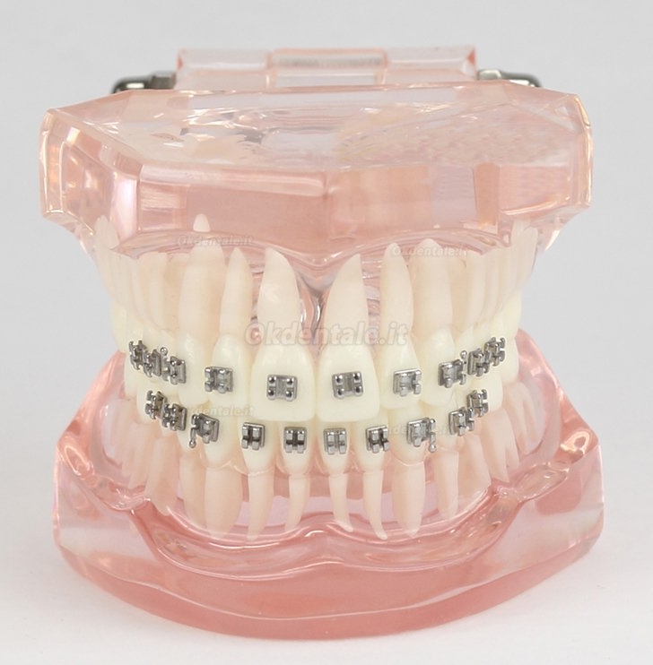 Malocclusione Modello corretto con 20 Brackets M-3001