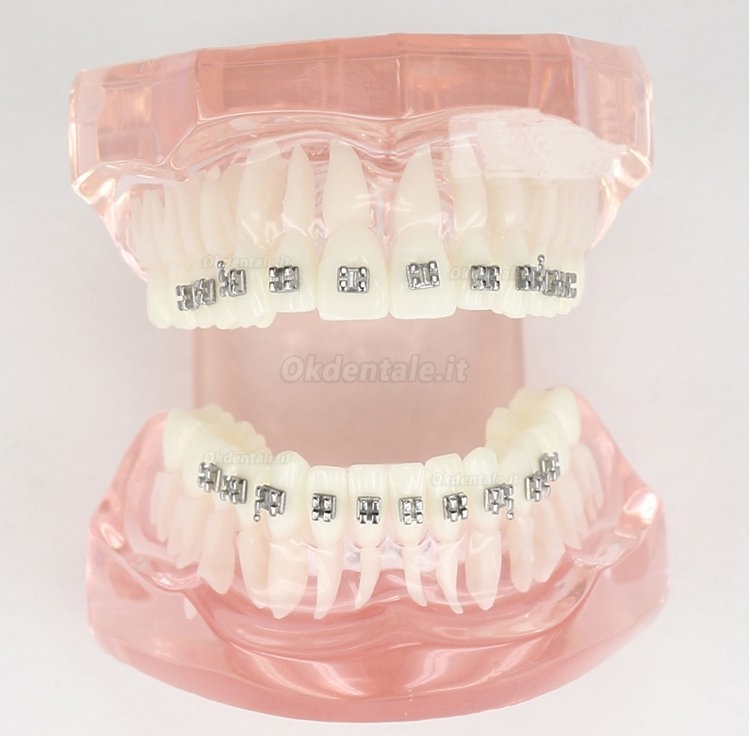 Malocclusione Modello corretto con 20 Brackets M-3001