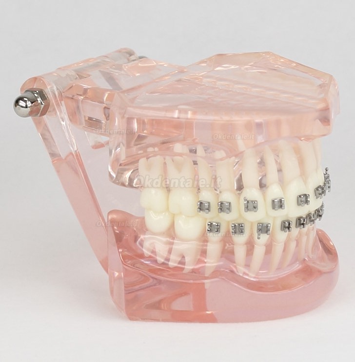 Malocclusione Modello corretto con 20 Brackets M-3001