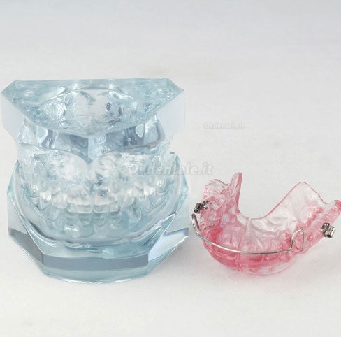 Modello dopo il trattamento ortodontico M-3006