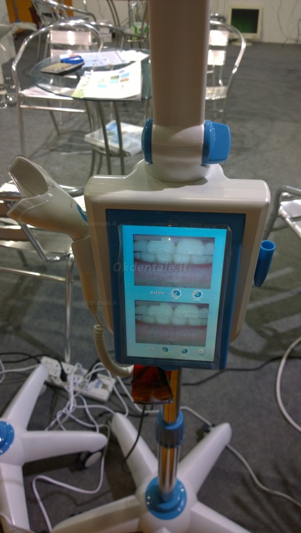 Magenta® MD-887A Lampade sbiancamento dentale touch screen da 7 inch Schermo