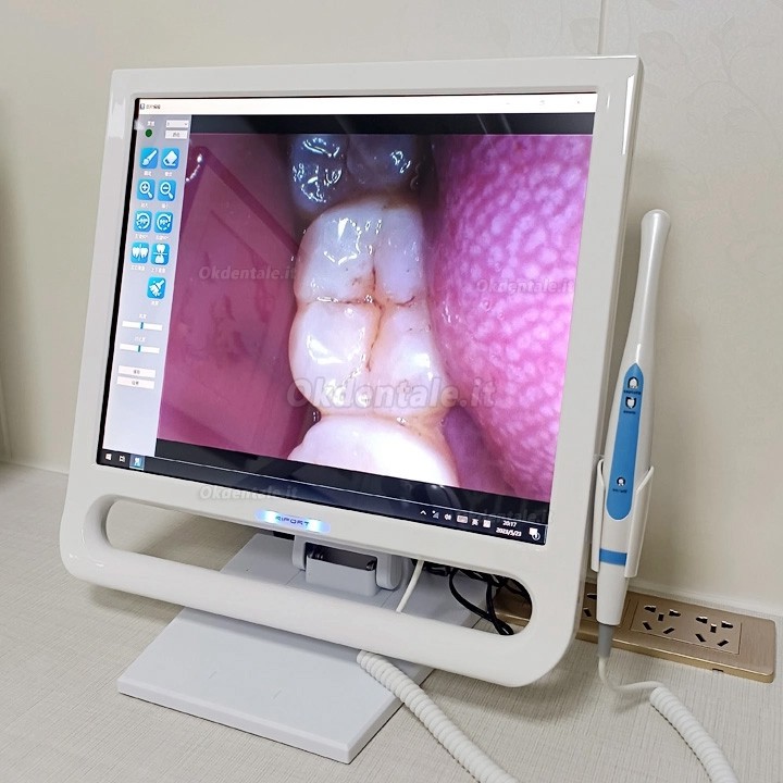 Magenta YF-1700P+ Telecamera intraorale dentale touch screen da 17 pollici