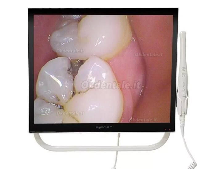 Magenta YFHD-D telecamera intraorale dentale 1/4 Sony CCD con monitor da 17 pollici