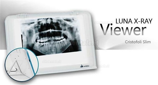 HISHINE® LUNA Dental Negatoscopio