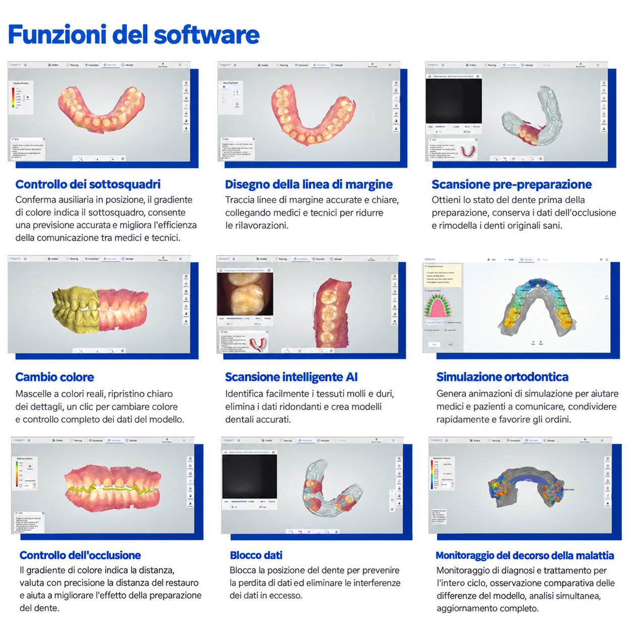 Scanner intraorale 3D wireless Panda P4 con 6 puntali di scansione