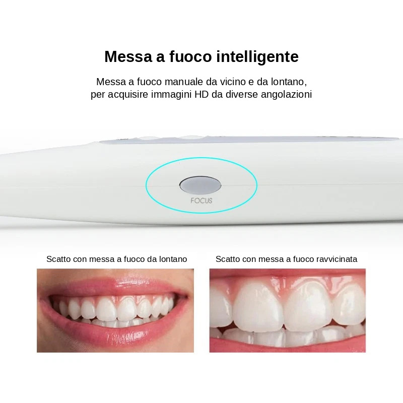 Telecamera intraorale dentale USB 4K HD MLG CF686B, sensore da 1/2,8 pollici Telecamera intraorale dentale USB 4K HD MLG CF686B, sensore da 1/2,8 pollici