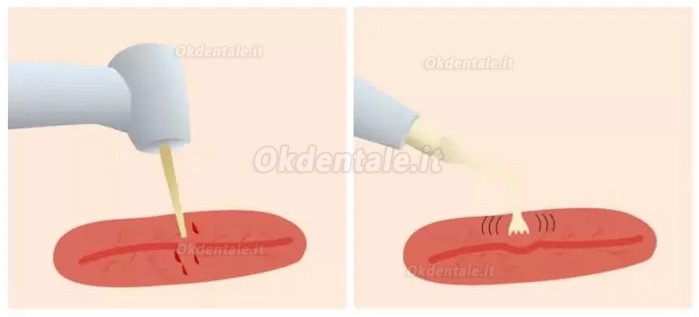 Refine MaxSurgery Unità per piezochirurgia (chirurgia piezoelettrica odontoiatria) Refine MaxSurgery Unità per piezochirurgia (chirurgia piezoelettrica odontoiatria)