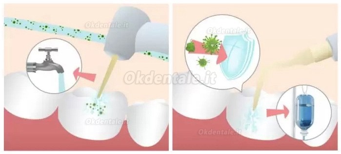 Refine MaxSurgery Unità per piezochirurgia (chirurgia piezoelettrica odontoiatria) Refine MaxSurgery Unità per piezochirurgia (chirurgia piezoelettrica odontoiatria)