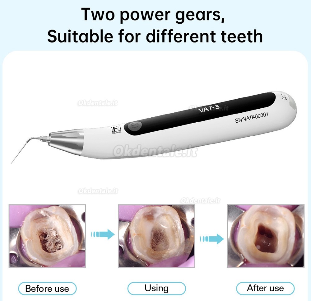 REFINE VAT-3 attivatore endo ultrasonico (endoattivatore)