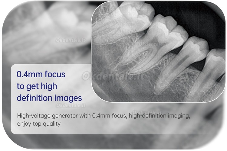 Refine® VeRay apparecchi radiologici portatili odontoiatrica + X-ray sensore intraorale