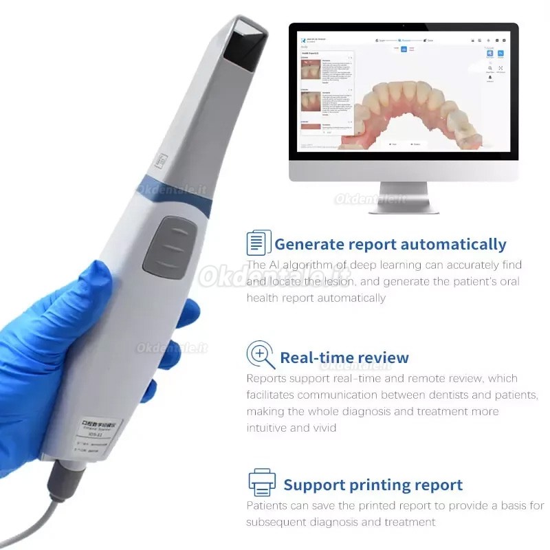 Runyes 3DS V3 PRO Scanner intraorale dentale, Scanner 3D dentale digitale con software Runyes 3DS V3 PRO Scanner intraorale dentale, Scanner 3D dentale digitale con software