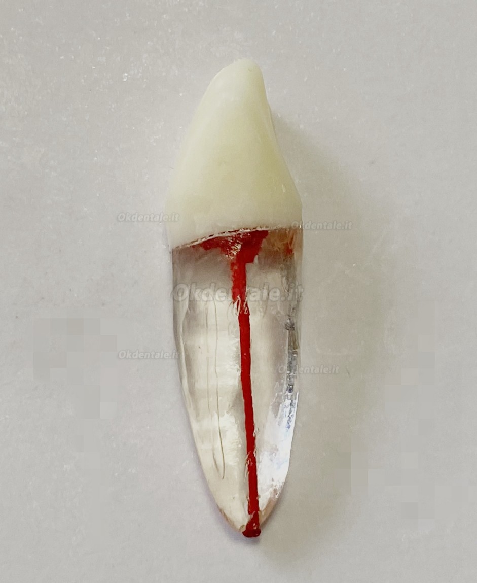 Modello di denti dentali per pratica del Lime endodontiche dentali