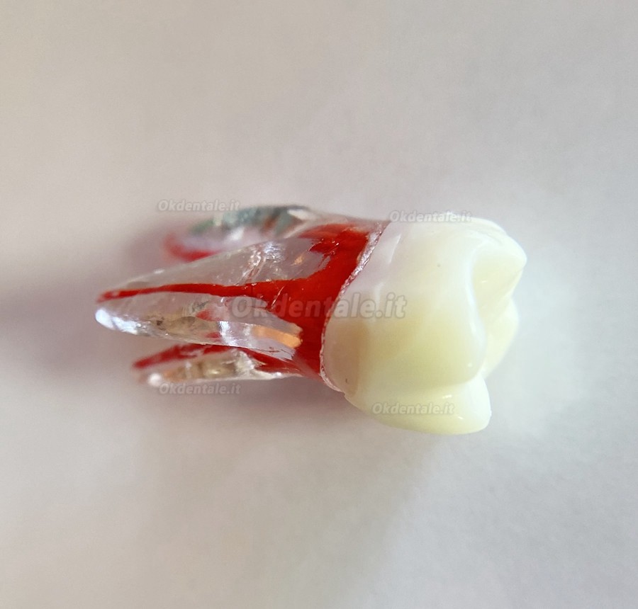 Modello di denti dentali per pratica del Lime endodontiche dentali