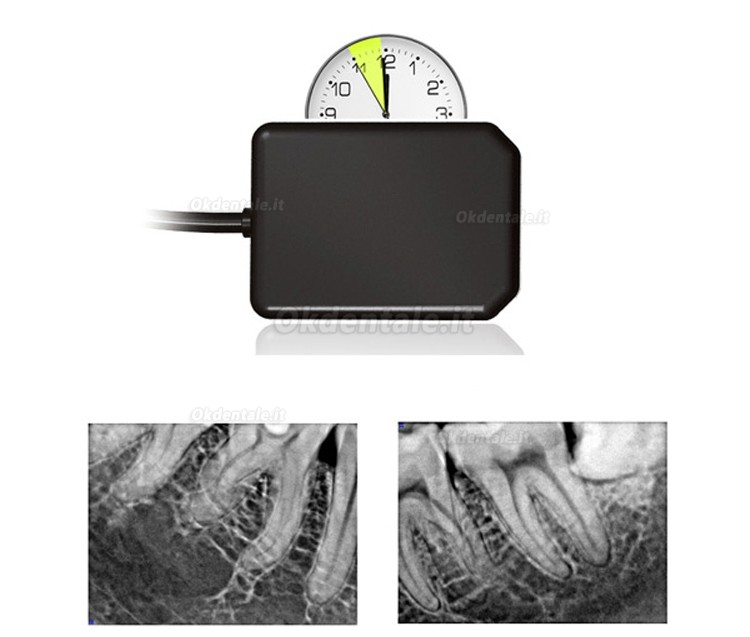Dentale Radiografia Endorale Portatile II  + Handy HDR 500/600 Dentale Sensori Endorali