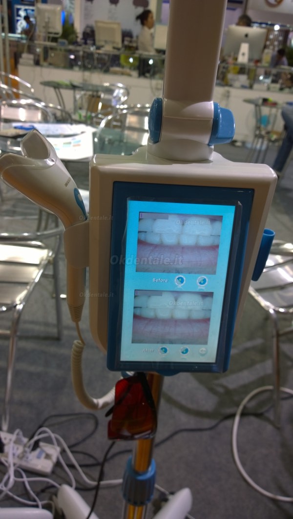 Magenta® MD-887B Lampade sbiancamento dentale touch screen da 7inch éSchermo con caméra