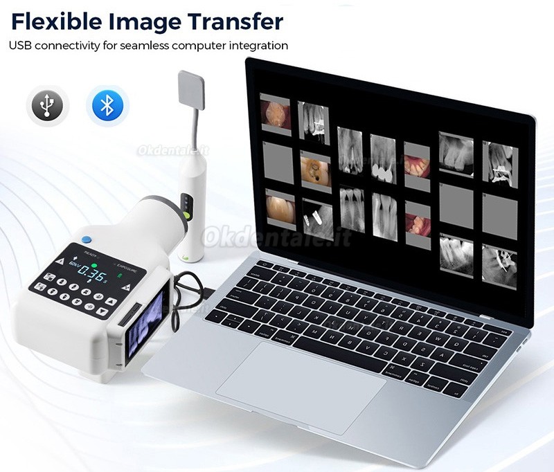 Apparecchio radiologico portatile dentale (schermo integrato) + Sensore rvg dentale senza fili iRay Pluto 0002XW Apparecchio radiologico portatile dentale (schermo integrato) + Sensore rvg dentale senza fili iRay Pluto 0002XW